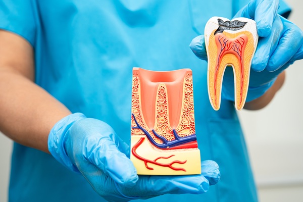 Reasons Why A Root Canal Might Be Needed